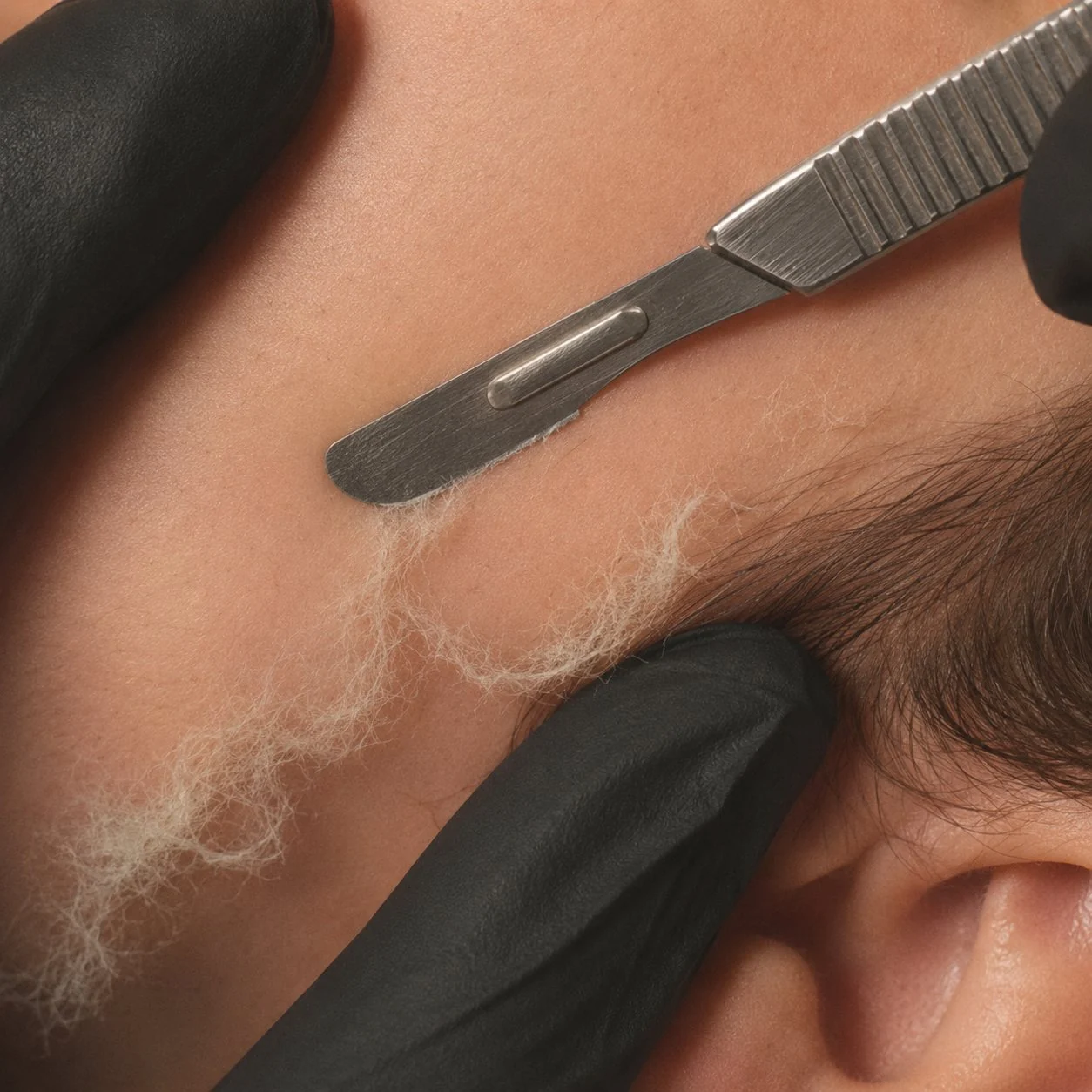 Close-up of a professional dermaplaning treatment